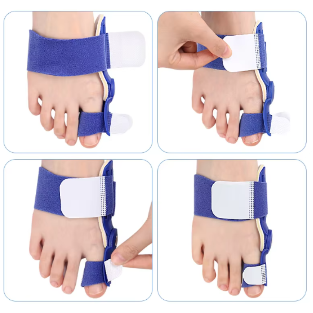 Correcteur universel pour hallux valgus.